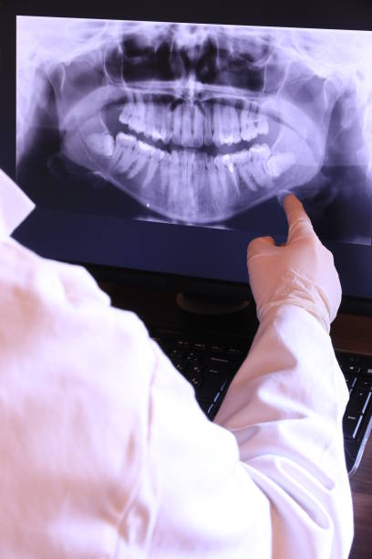 Best Emergency Gum Treatment in Glendale, CO