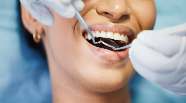 Best Emergency Dental Care for Broken or Chipped Teeth in Glendale, CO